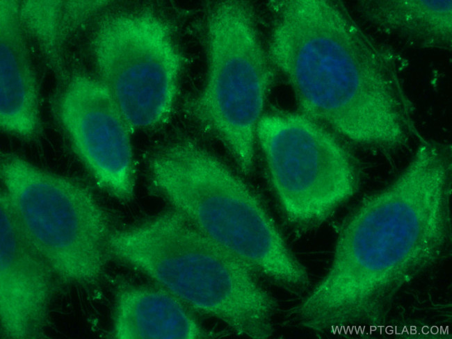 ENO1/2/3 Antibody in Immunocytochemistry (ICC/IF)