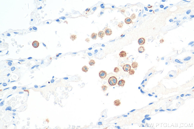 CD206 Antibody in Immunohistochemistry (Paraffin) (IHC (P))