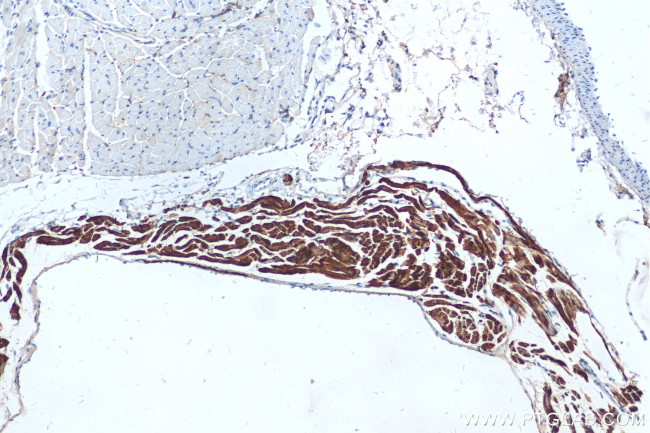 MYL7 Antibody in Immunohistochemistry (Paraffin) (IHC (P))