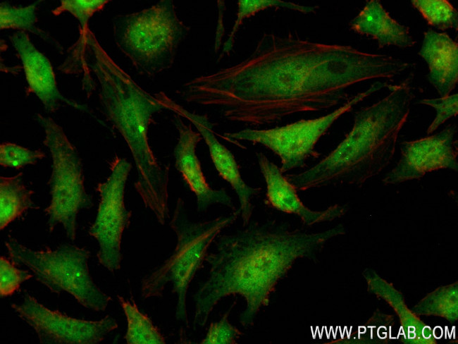 SNAI1 Antibody in Immunocytochemistry (ICC/IF)