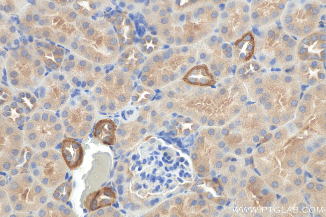 GPR126 Antibody in Immunohistochemistry (Paraffin) (IHC (P))