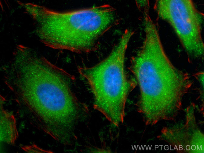 GAPDH Antibody in Immunocytochemistry (ICC/IF)