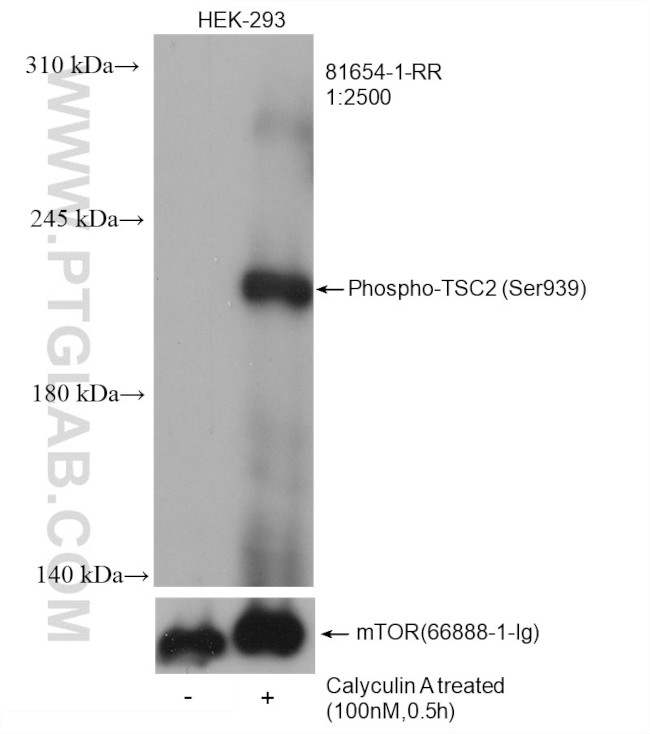 Phospho-TSC2 (Ser939) Antibody in Western Blot (WB)