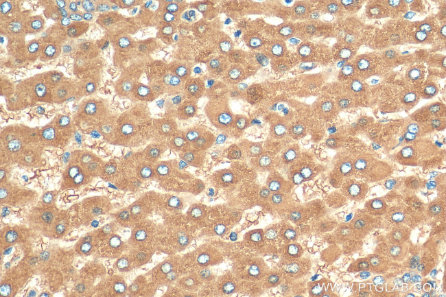 Transferrin Antibody in Immunohistochemistry (Paraffin) (IHC (P))