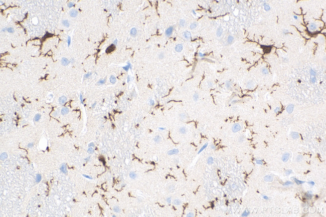 IBA1 Antibody in Immunohistochemistry (Paraffin) (IHC (P))