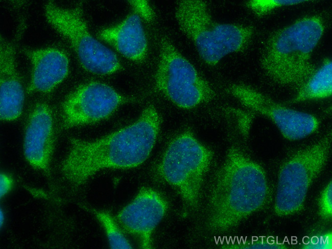 TGF Beta 1 Antibody in Immunocytochemistry (ICC/IF)