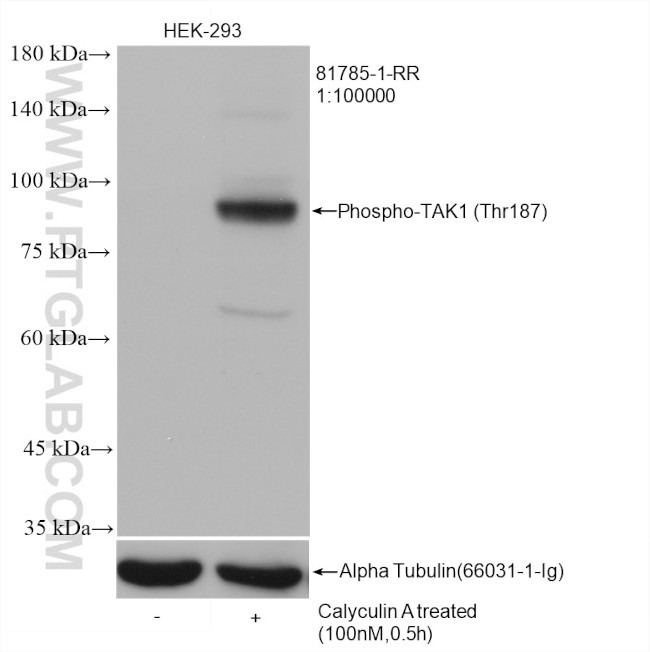 Phospho-TAK1 (Thr187) Antibody in Western Blot (WB)