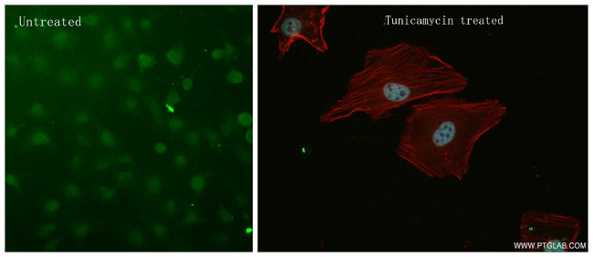ATF4 Antibody in Immunocytochemistry (ICC/IF)