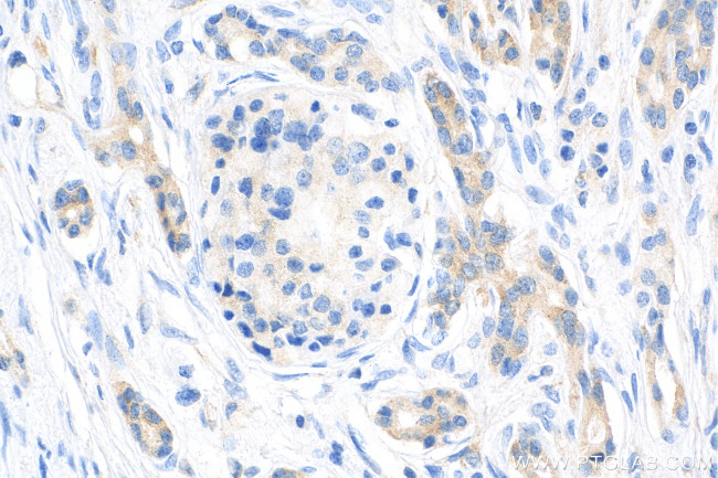 IGF2BP3 Antibody in Immunohistochemistry (Paraffin) (IHC (P))