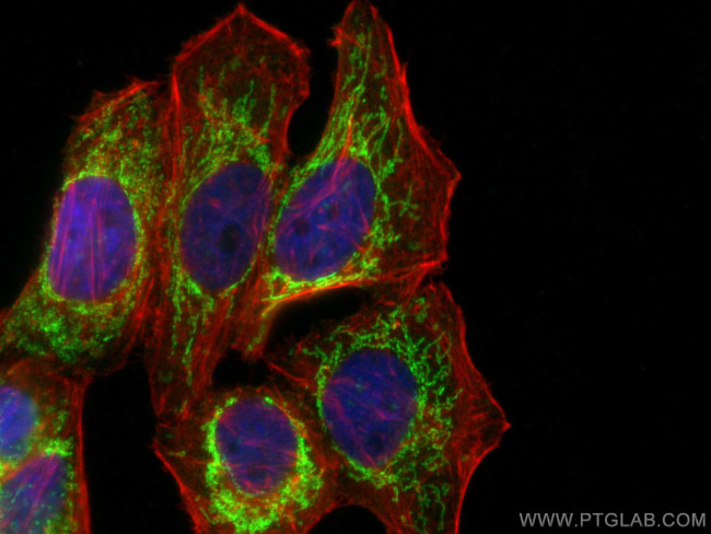 PRDX3 Antibody in Immunocytochemistry (ICC/IF)