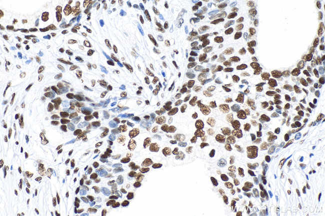 Phospho-CREB1 (Ser133) Antibody in Immunohistochemistry (Paraffin) (IHC (P))