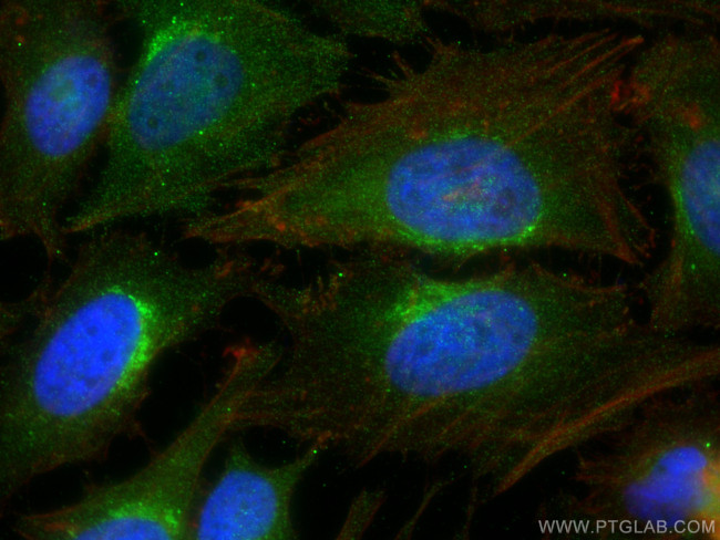 LDHB Antibody in Immunocytochemistry (ICC/IF)