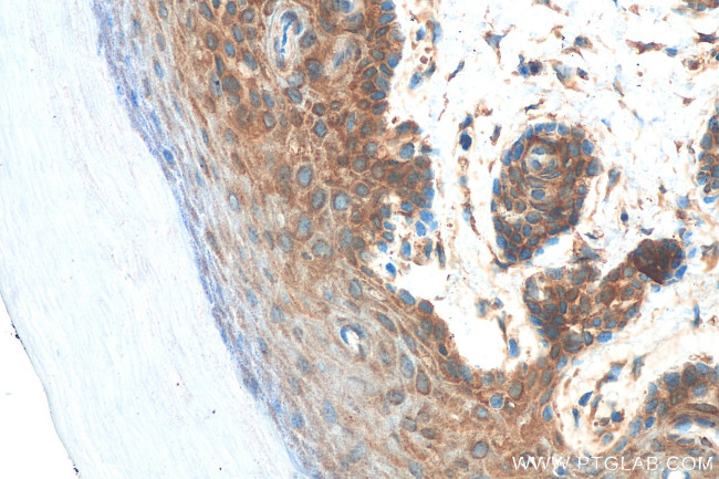 GSK3B Antibody in Immunohistochemistry (Paraffin) (IHC (P))