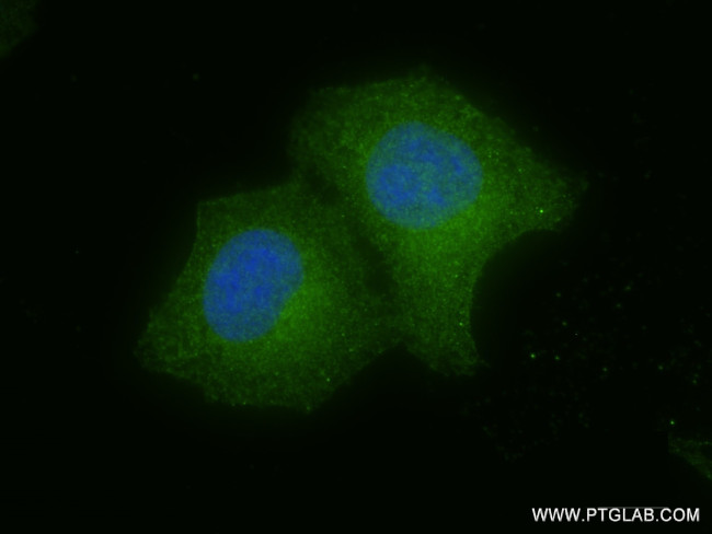 SLC7A11/xCT Antibody in Immunocytochemistry (ICC/IF)