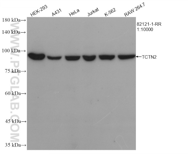 TCTN2 Antibody in Western Blot (WB)