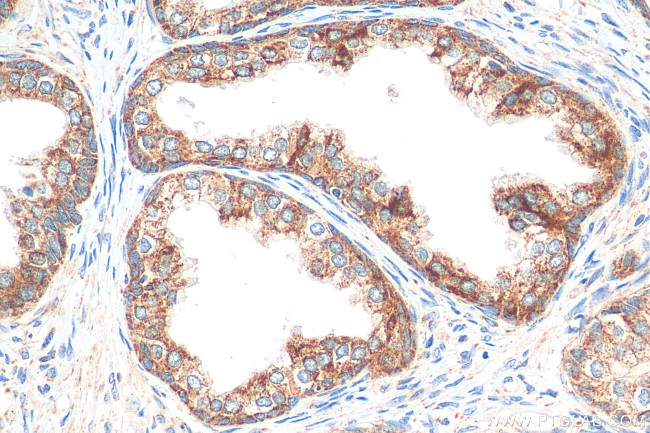 SIRT3 Antibody in Immunohistochemistry (Paraffin) (IHC (P))