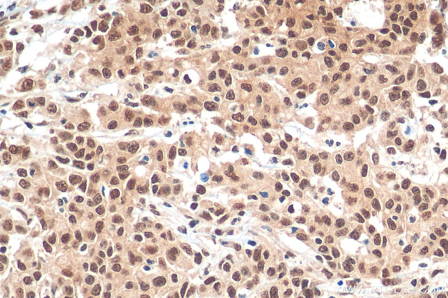HNRNPL Antibody in Immunohistochemistry (Paraffin) (IHC (P))