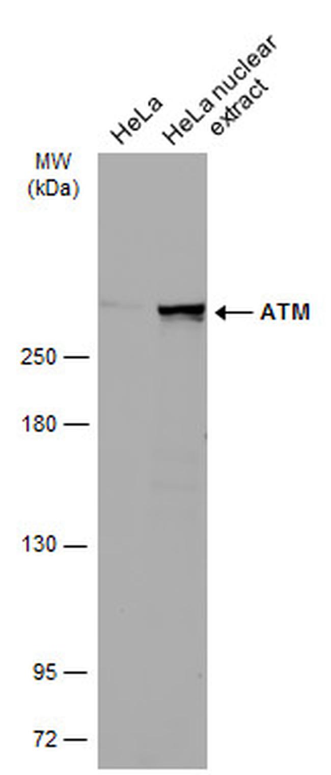 ATM Monoclonal Antibody 5C2 82314 atm-monoclonal-antibody-5c2-82314