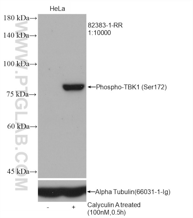 Phospho-TBK1 (Ser172) Antibody in Western Blot (WB)