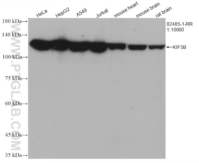 KIF5B Antibody in Western Blot (WB)