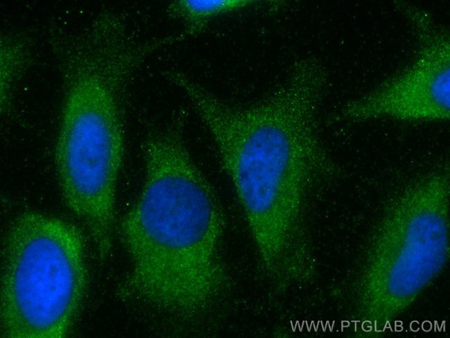 LASP1 Antibody in Immunocytochemistry (ICC/IF)