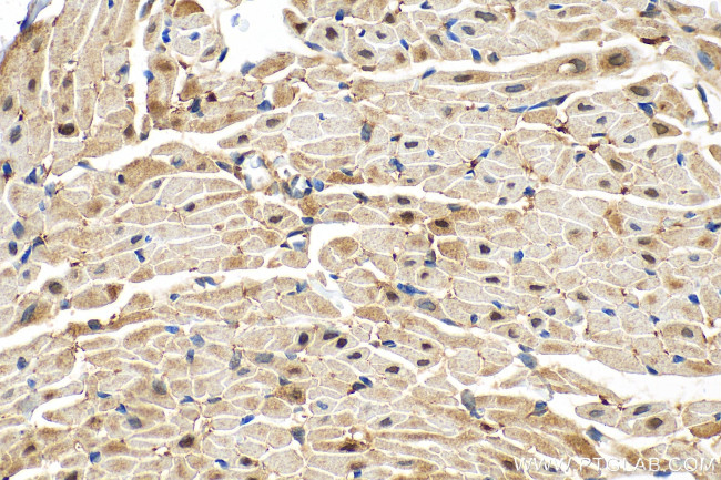 PTPN11 Antibody in Immunohistochemistry (Paraffin) (IHC (P))