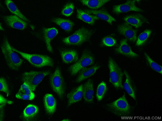 EIF3D Antibody in Immunocytochemistry (ICC/IF)