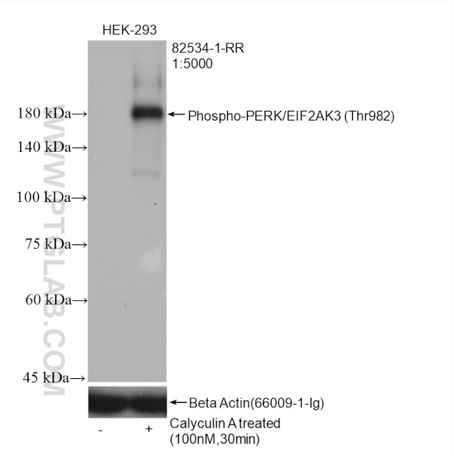 Phospho-PERK/EIF2AK3 (Thr982) Antibody in Western Blot (WB)