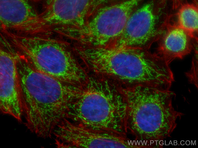 Tim23 Antibody in Immunocytochemistry (ICC/IF)