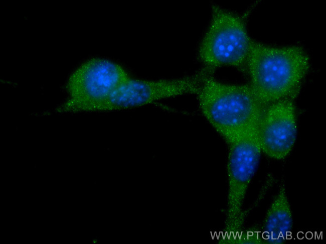 Stathmin 1 Antibody in Immunocytochemistry (ICC/IF)