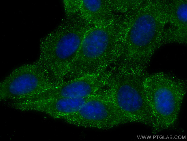SPHK1 Antibody in Immunocytochemistry (ICC/IF)