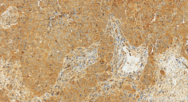 GCLM Antibody in Immunohistochemistry (Paraffin) (IHC (P))