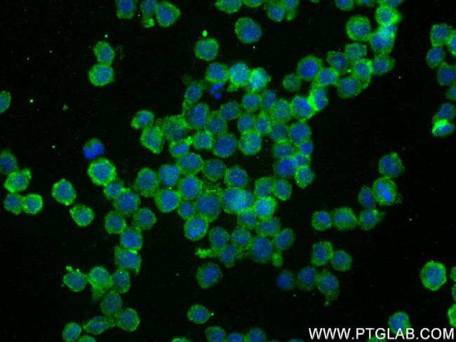 Piezo1 (extracellular domain) Antibody in Immunocytochemistry (ICC/IF)