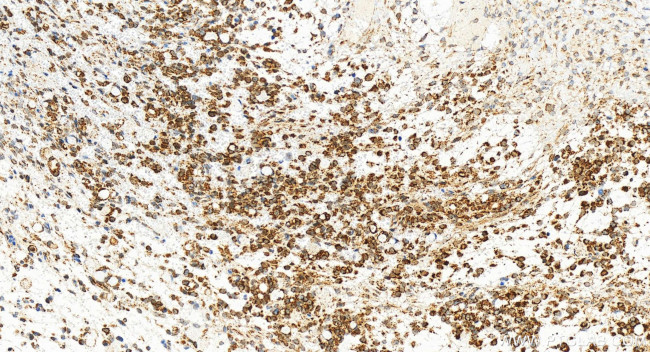 VDAC3 Antibody in Immunohistochemistry (Paraffin) (IHC (P))