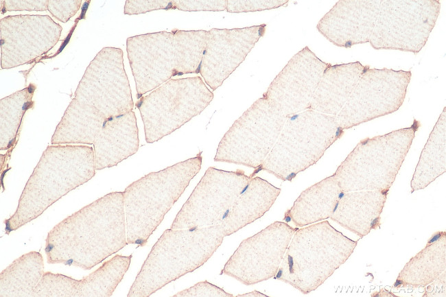 FNDC5 Antibody in Immunohistochemistry (Paraffin) (IHC (P))