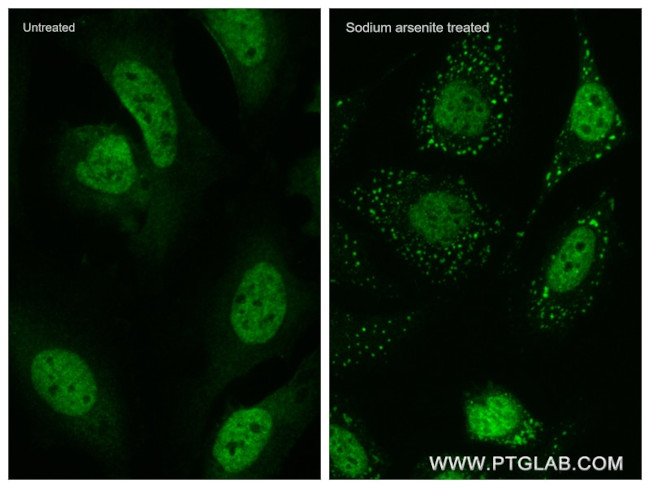 TIA1 Antibody in Immunocytochemistry (ICC/IF)