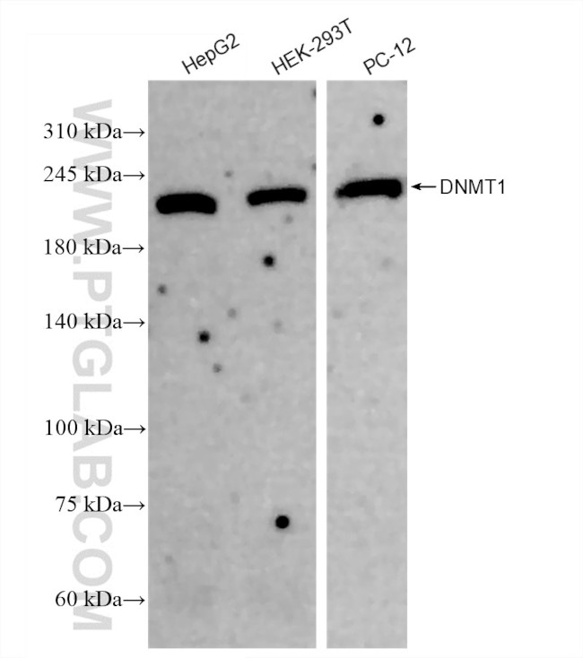 DNMT1 Antibody in Western Blot (WB)