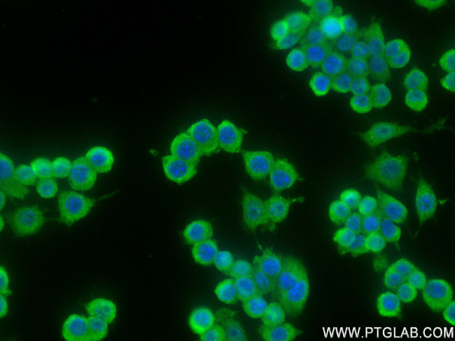FGF-21 Antibody in Immunocytochemistry (ICC/IF)