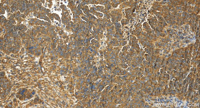 ATG13 Antibody in Immunohistochemistry (Paraffin) (IHC (P))