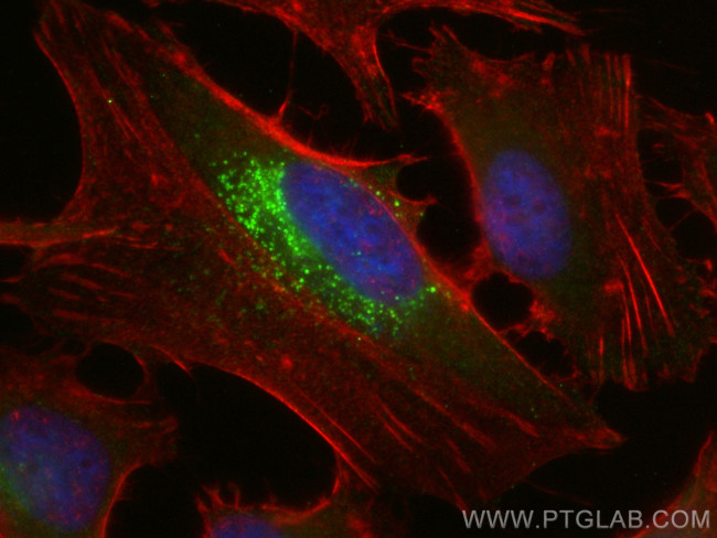 LDLR Antibody in Immunocytochemistry (ICC/IF)