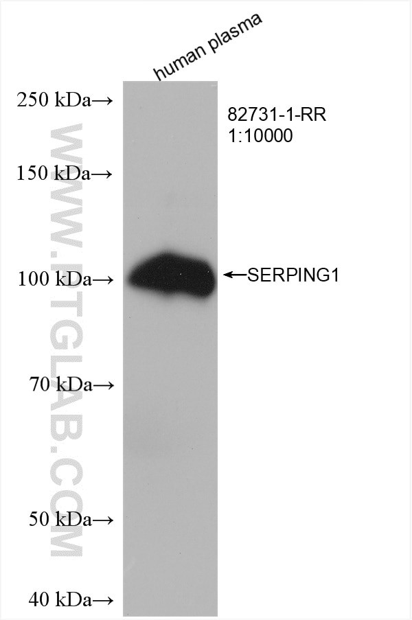 SERPING1 Antibody in Western Blot (WB)