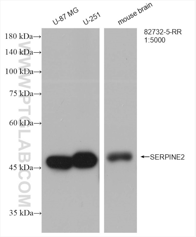 SERPINE2 Antibody in Western Blot (WB)