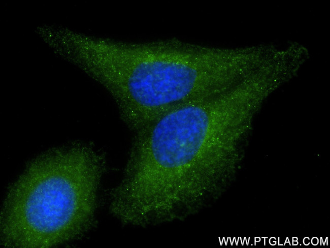 BST2 Antibody in Immunocytochemistry (ICC/IF)