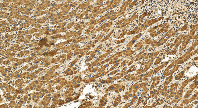 MRPS16 Antibody in Immunohistochemistry (Paraffin) (IHC (P))