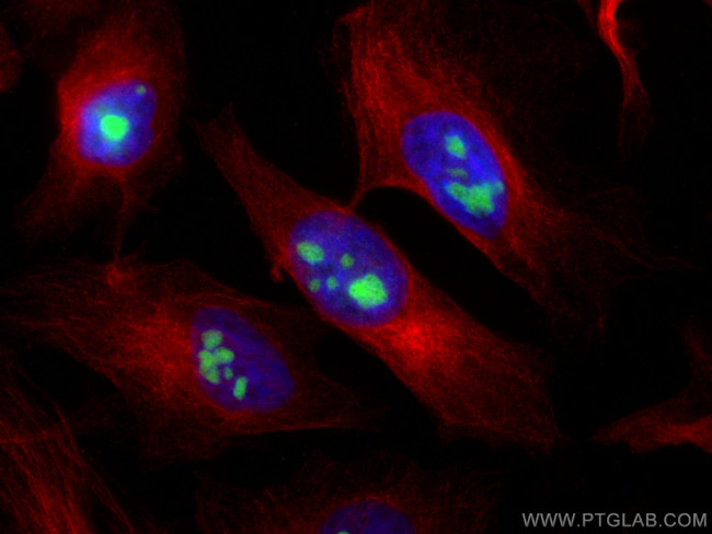 BOP1 Antibody in Immunocytochemistry (ICC/IF)
