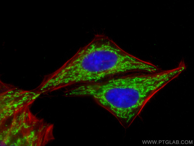 CHCHD3 Antibody in Immunocytochemistry (ICC/IF)