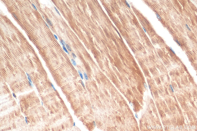Desmin Antibody in Immunohistochemistry (Paraffin) (IHC (P))