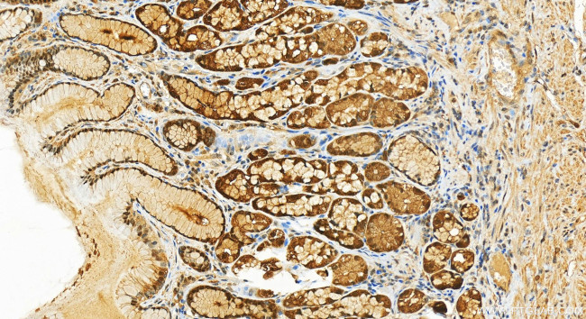 Thioredoxin Antibody in Immunohistochemistry (Paraffin) (IHC (P))