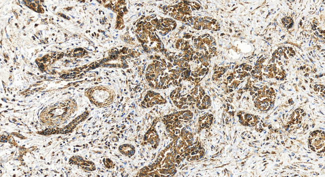 OGDH Antibody in Immunohistochemistry (Paraffin) (IHC (P))