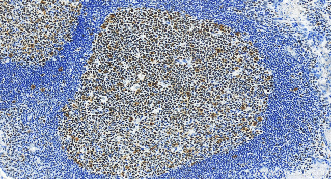 MSH2 Antibody in Immunohistochemistry (Paraffin) (IHC (P))